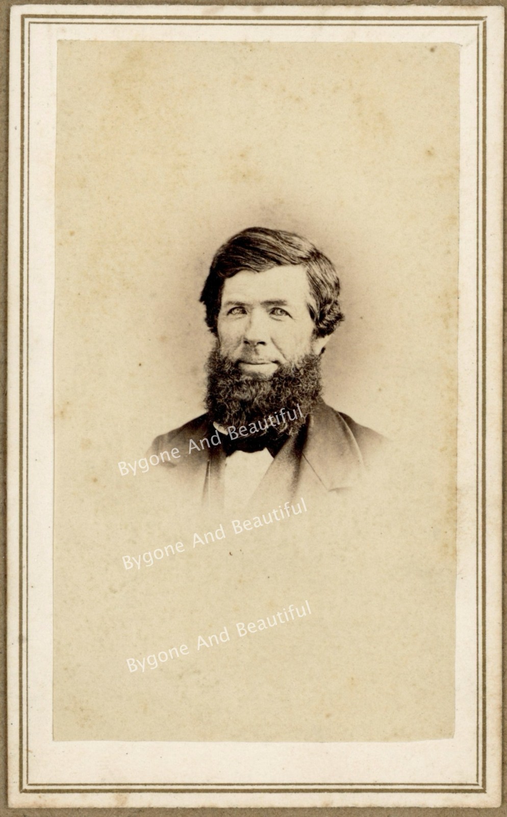 CDV Handsome Man Civil War Era With A Smile That Beard