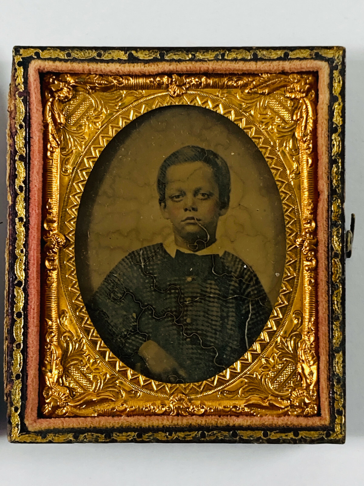 Antique 1/9th Ambrotype Sad Boy Pink Cheeks Birth defect? Bog Eyes w/ Case