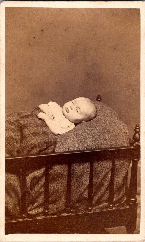Child Post Mortem, Close-Up CDV Photo, c1870 #1752